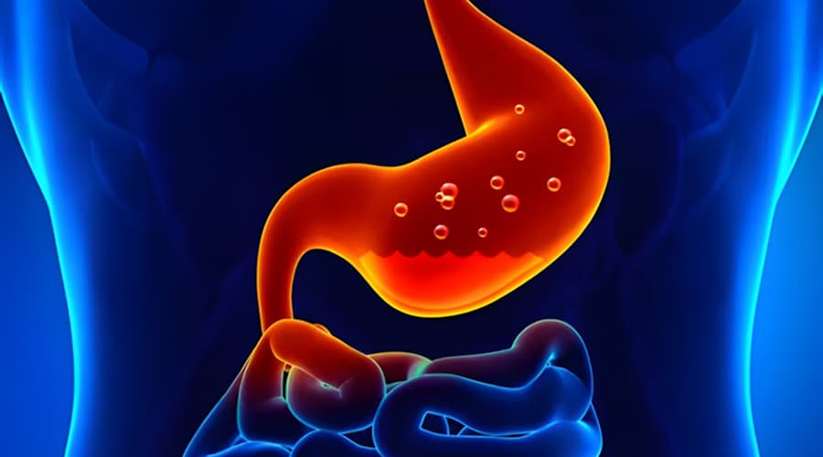 Gastritis