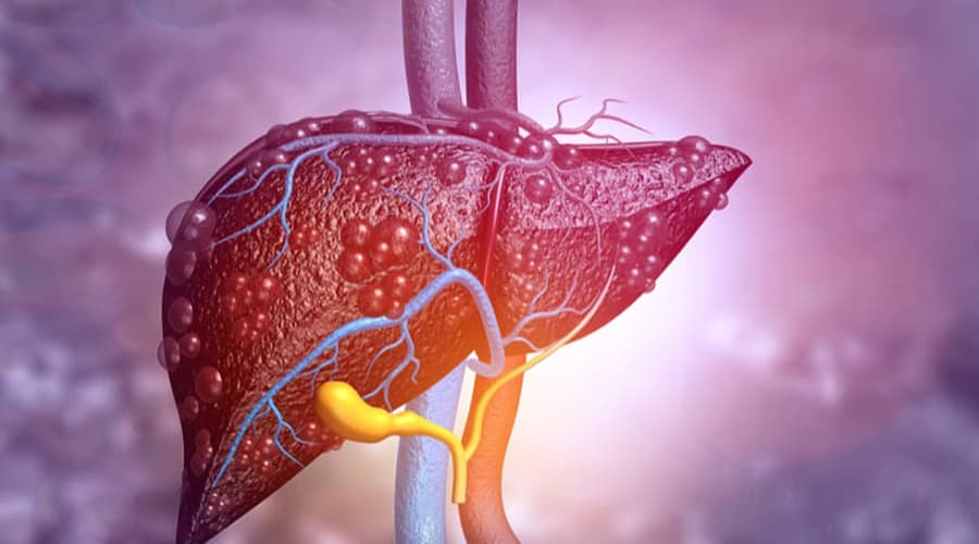 Hepatitis Crónica