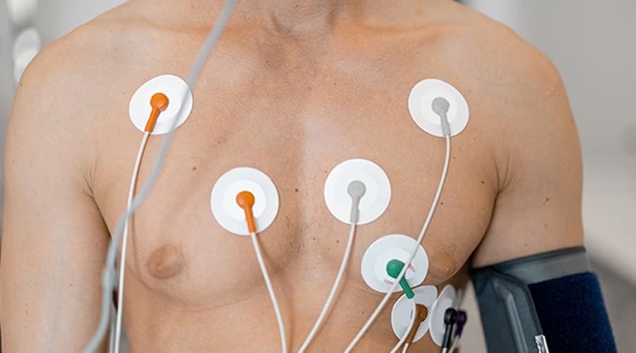 Electrocardiograma